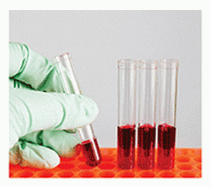 בדיקת המוגלובין A1C