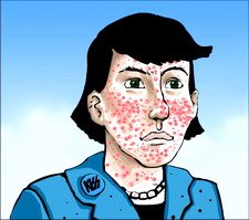 כיצד לטפל בפצעי בגרות?