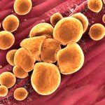 טריגליצרידים – למה זה חשוב?