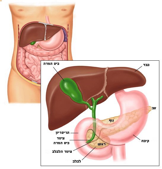 סוכרת מסוג 1