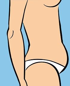 מדענים זיהו גנים חדשים הקשורים לשומן