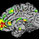 דגים משפרים את תפקודי המוח