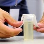 בדיקת שתן לאבחון רכיבי הדיאטה