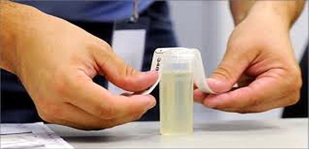 בדיקת שתן לאבחון רכיבי הדיאטה