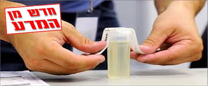 בדיקת שתן לאבחון רכיבי הדיאטה