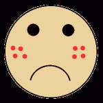 האם יש קשר בין פצעי בגרות (אקנה) למזון?