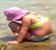 השמנה ואלרגיה