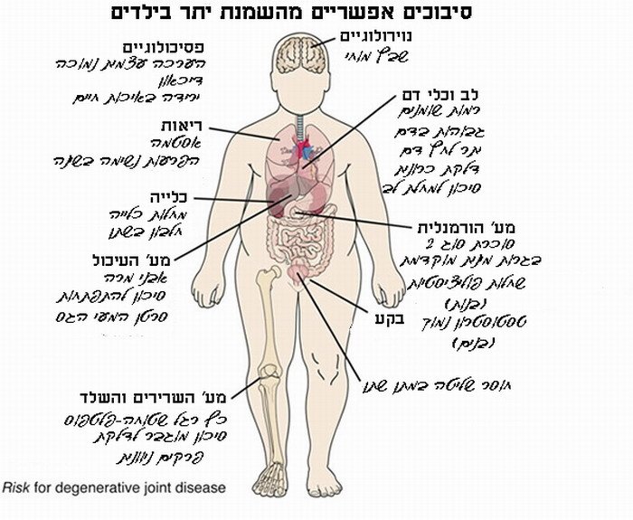 סיכונים בהשמנת יתר בילדים ומתבגרים