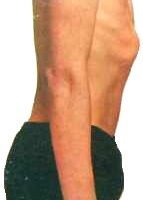 אני חייב לעלות במשקל – מה עושים?